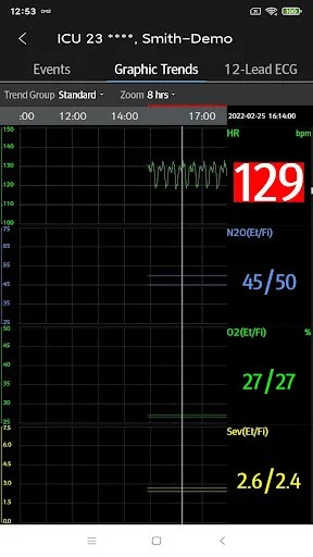Mindray Mobile Viewer ডাউনলোড করুন – রিয়েল-টাইম পেশেন্ট মনিটরিং - Screenshot 7