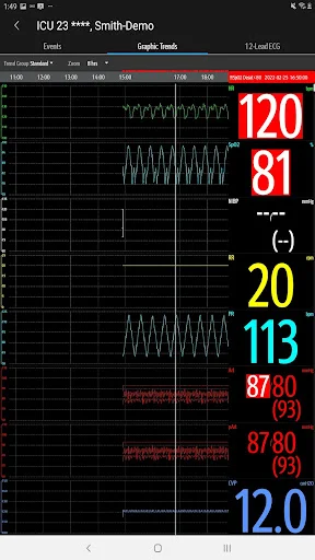 Mindray Mobile Viewer ডাউনলোড করুন – রিয়েল-টাইম পেশেন্ট মনিটরিং - Screenshot 23