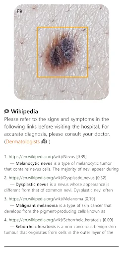 Model Dermatol ডাউনলোড করুন – চর্মরোগ শনাক্তকরণের সেরা অ্যাপ - Screenshot 3