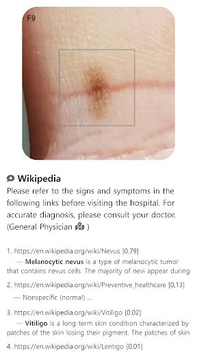 Model Dermatol ডাউনলোড করুন – চর্মরোগ শনাক্তকরণের সেরা অ্যাপ - Screenshot 10